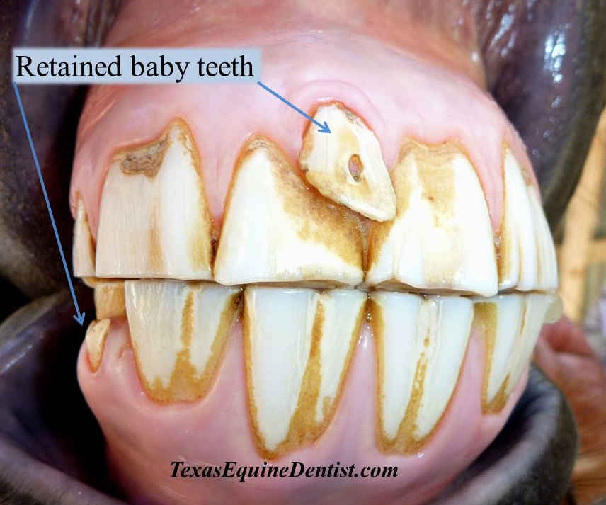 deciduous teeth retained